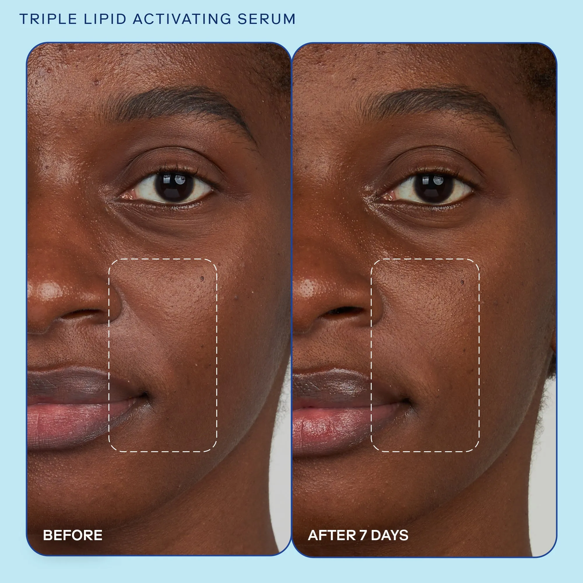 Barrier  (Refill) Triple Lipid Activating Serum