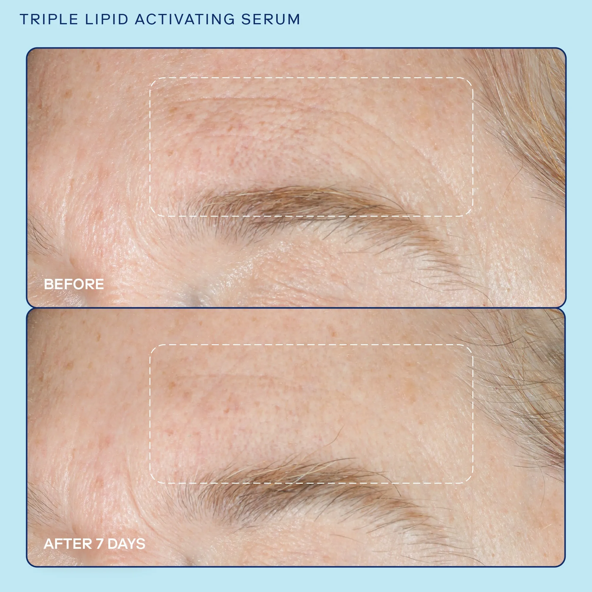 Barrier  (Refill) Triple Lipid Activating Serum