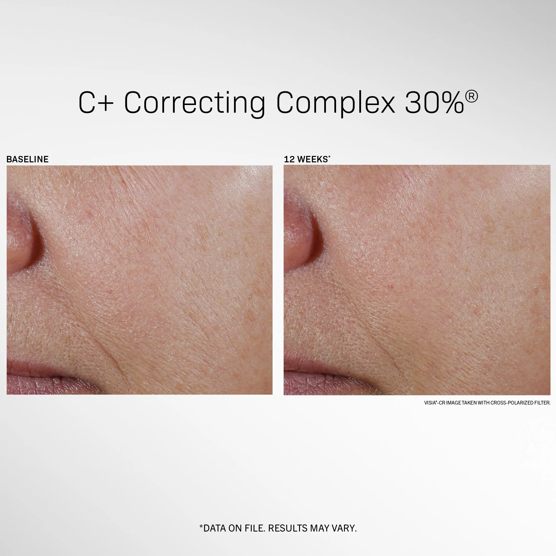 C  Correcting Complex 30%®
