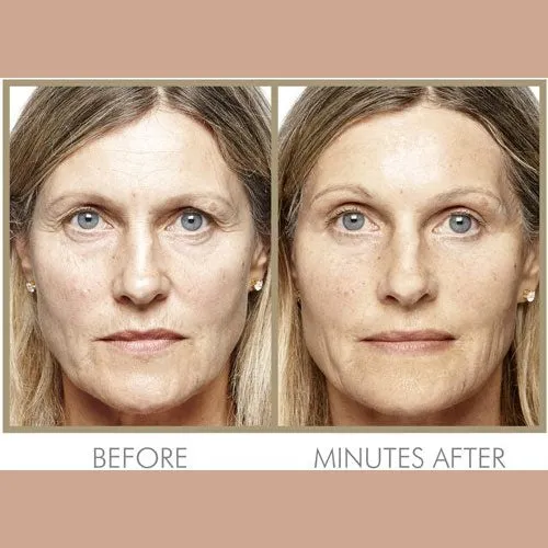 Genie Instant Smoother 30ml by Genie Beauty (Ships in 2-3 Weeks)