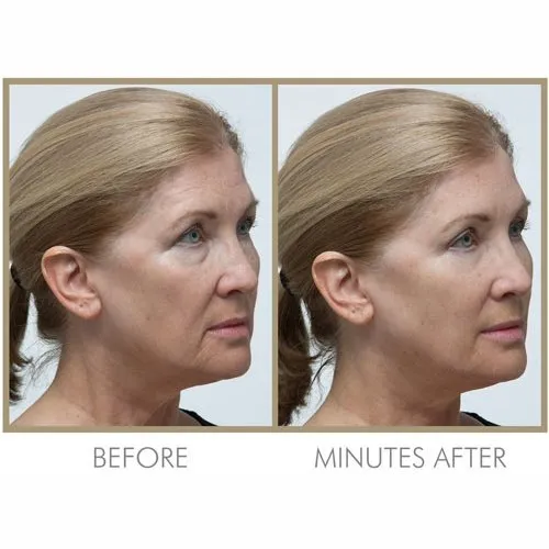 Genie Instant Smoother 30ml by Genie Beauty (Ships in 2-3 Weeks)