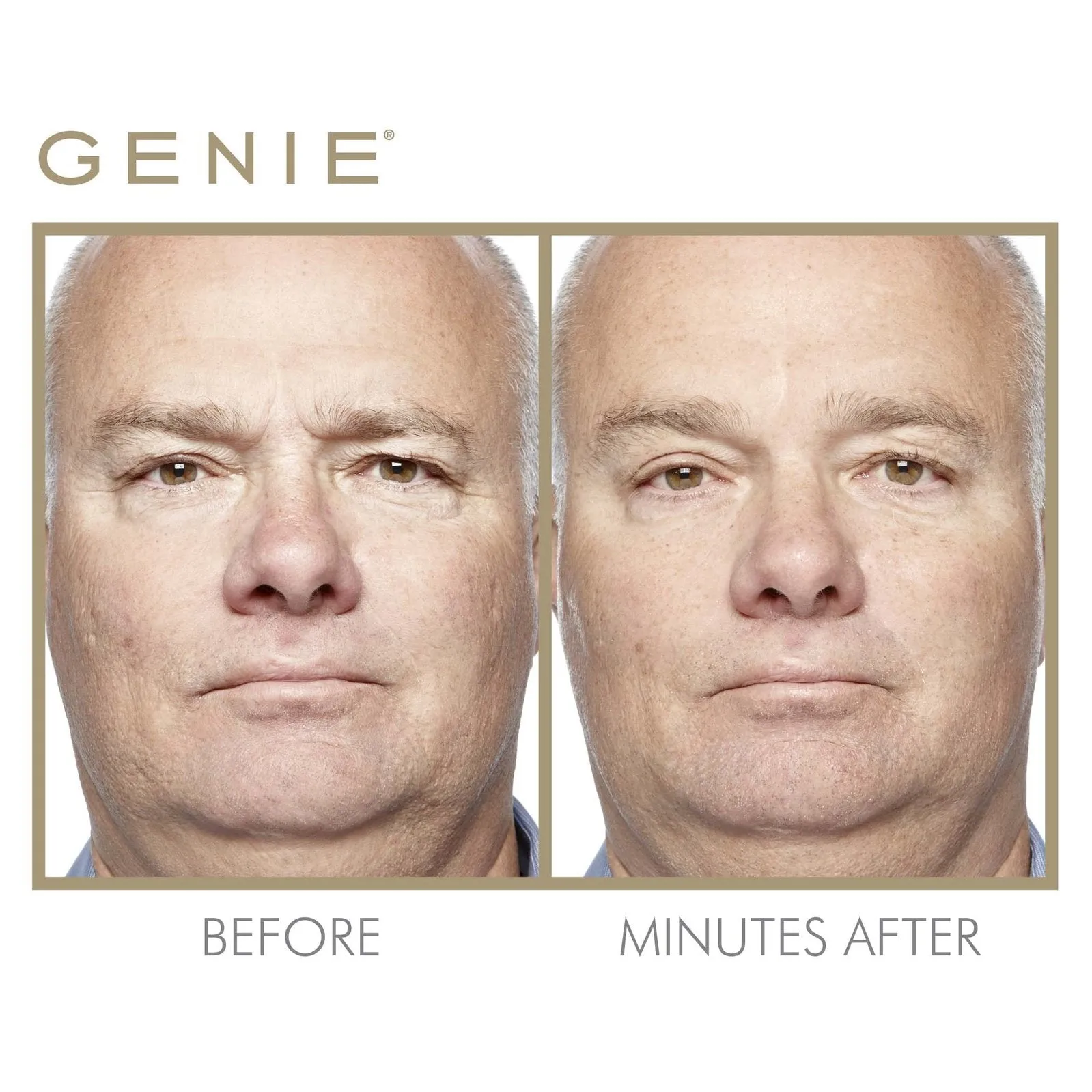Genie Instant Smoother 30ml by Genie Beauty (Ships in 2-3 Weeks)