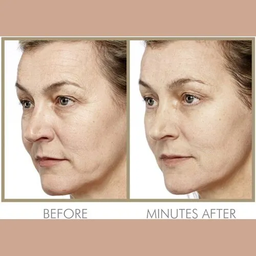 Genie Instant Smoother 30ml by Genie Beauty (Ships in 2-3 Weeks)